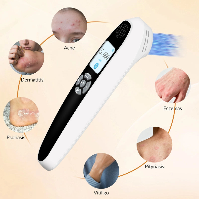 Portable 308nm UVB Phototherapy Device – Effective for Vitiligo & Psoriasis at Home